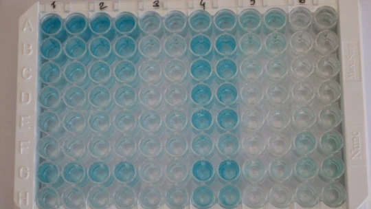 'Sabun bile yapamazlar' dendi antikor test kiti geliştirdiler