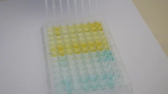 'Sabun bile yapamazlar' dendi antikor test kiti geliştirdiler