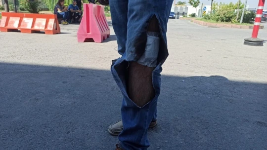 Acemi kasaplar hastanelik oldu