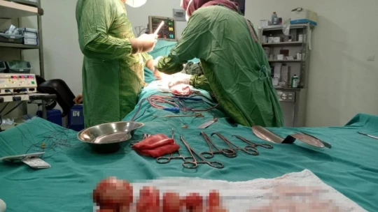Ağrı şikayetiyle hastaneye gitti, rahim duvarından 23 miyom çıkarıldı