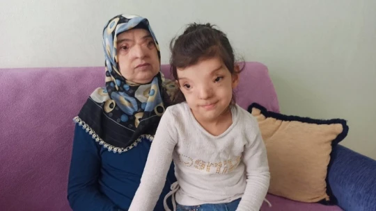 Bu hastalık dünyada sadece 4 kişide var