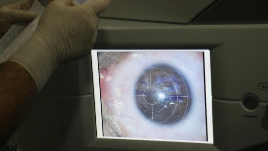 Gözlükle girdiler gözlüksüz çıktılar