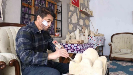 Kansere yakalandı, sanatla hayata tutundu