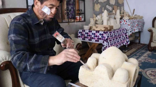 Kansere yakalandı, sanatla hayata tutundu