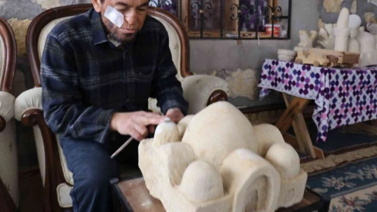 Kansere yakalandı, sanatla hayata tutundu