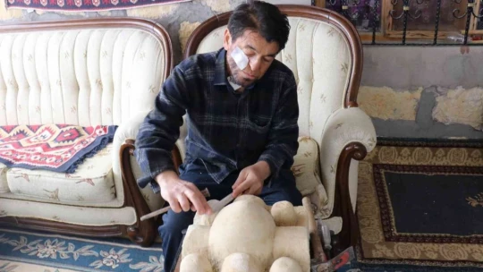 Kansere yakalandı, sanatla hayata tutundu