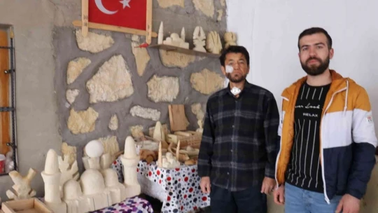 Kansere yakalandı, sanatla hayata tutundu