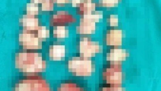 Ameliyatta doktor şoka uğradı