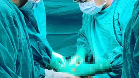 Korona virüs sayesinde 30 santimlik tümöründen kurtuldu