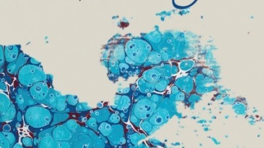 Online ebru sergisine ilgi