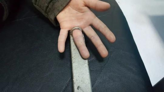 Parmağının sıkıştığı demir parçasıyla birlikte hastaneye kaldırıldı