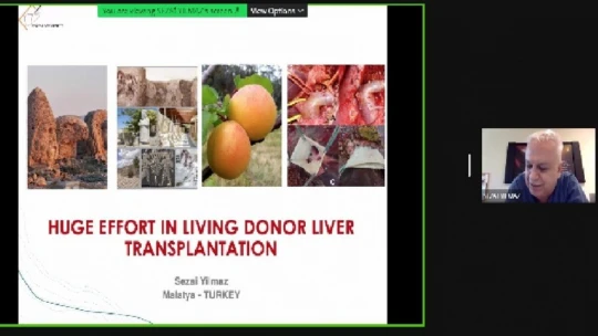 'Bir millet, iki devlet'