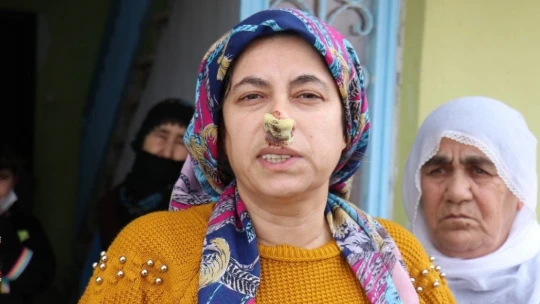 Sokak köpeklerinin saldırdığı kadın yaralandı