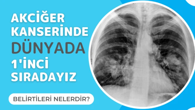 Akciğer kanserinde dünyada 1'inci sıradayız!