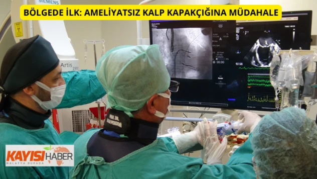 Ameliyatsız kalp kapakçığına müdahale