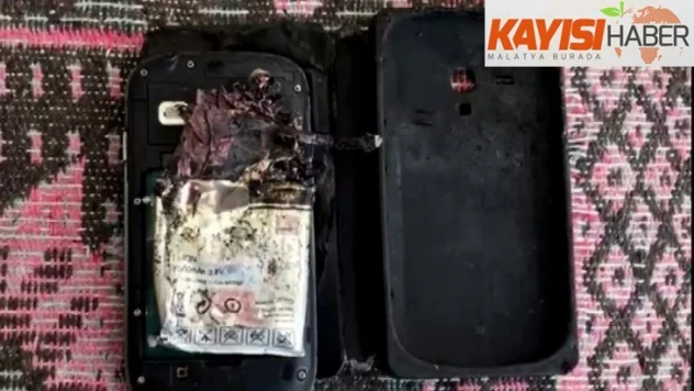 Patlayan cep telefonu bacağını parçaladı