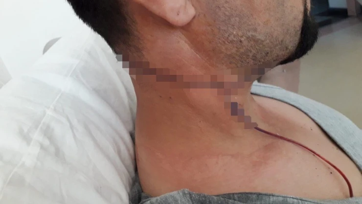 Sağlık memuru mesai arkadaşını falçatayla yaraladı