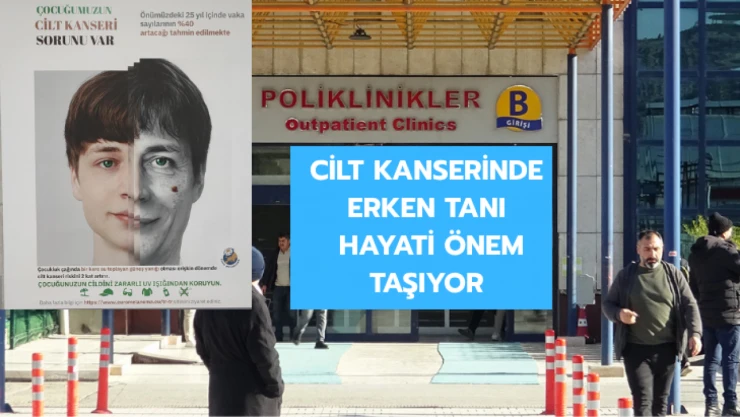 Cilt kanserinde erken tanı hayati önem taşıyor