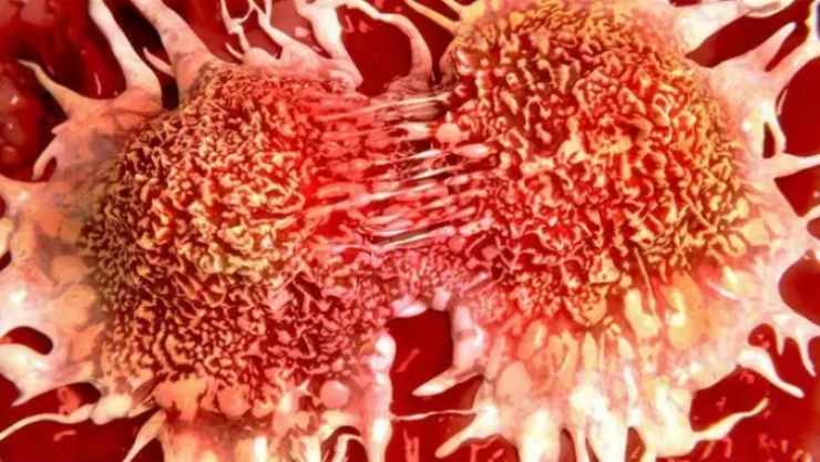 Genç erkeklerde bu kanser türüne dikkat