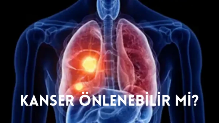 Kanser önlenebilir mi?