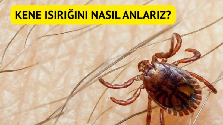 Kene ısırığını nasıl anlarız?