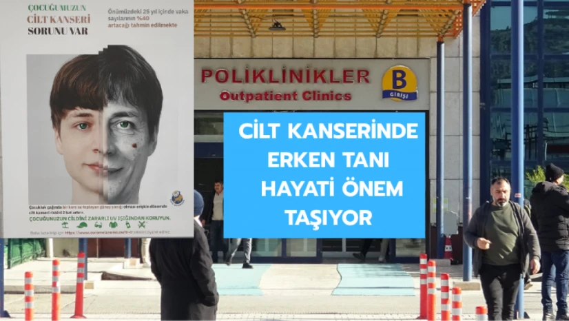 Cilt kanserinde erken tanı hayati önem taşıyor