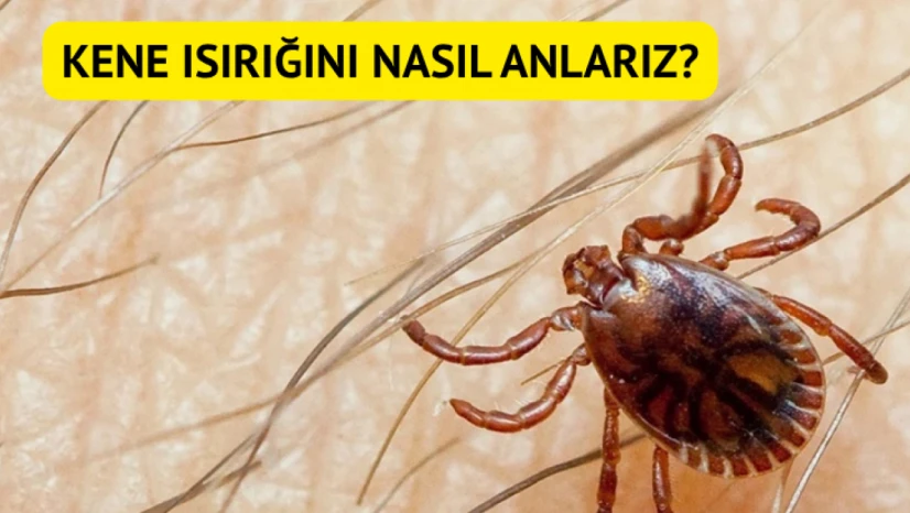 Kene ısırığını nasıl anlarız?